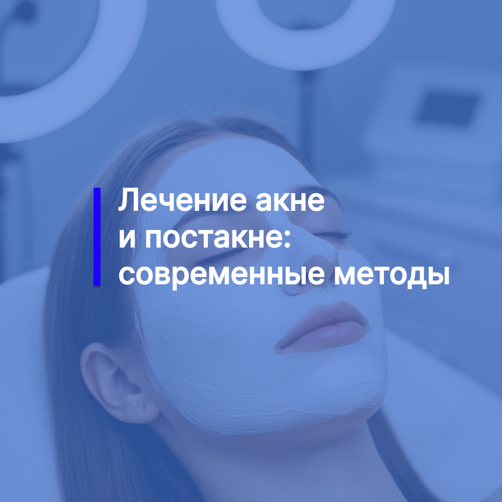 Лечение акне и постакне: современные методы